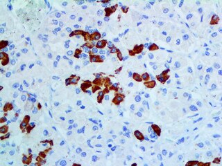 IHC of GH BSB-99 on a FFPE Pituitary Tissue